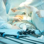 عوارض احتمالی عمل لاپاروسکوپی