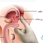 پروستاتیت چیست و چگونه درمان می‌شود؟