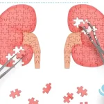 روش‌های مختلف جراحی سرطان کلیه