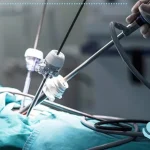 لاپاروسکوپی چیست و چه کاربردی دارد؟