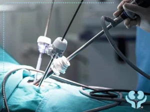 لاپاروسکوپی چیست و چه کاربردی دارد؟