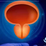 تفاوت بین سرطان پروستات و بزرگی خوش‌خیم آن
