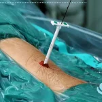 مزایا و معایب PCNL در درمان کلیه